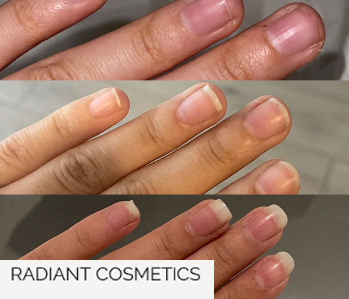 Radiant Cosmetics Nail 