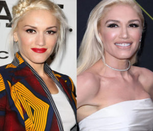 Gwen Stefani New Look (Plastic Surgery): What's The Secret?