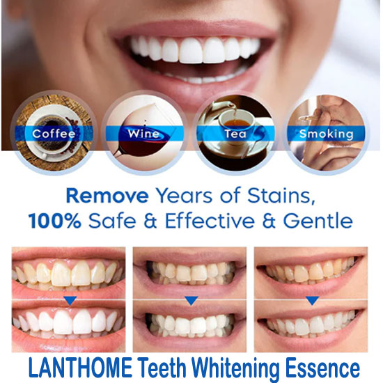 Herbaluxy Teeth Whitening Reviews1