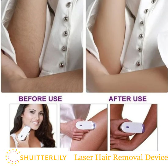 Shuitterlily laser Hair Removal Reviews